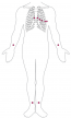 6.2 Cardiac Muscle and Electrical Activity – Fundamentals of Anatomy ...