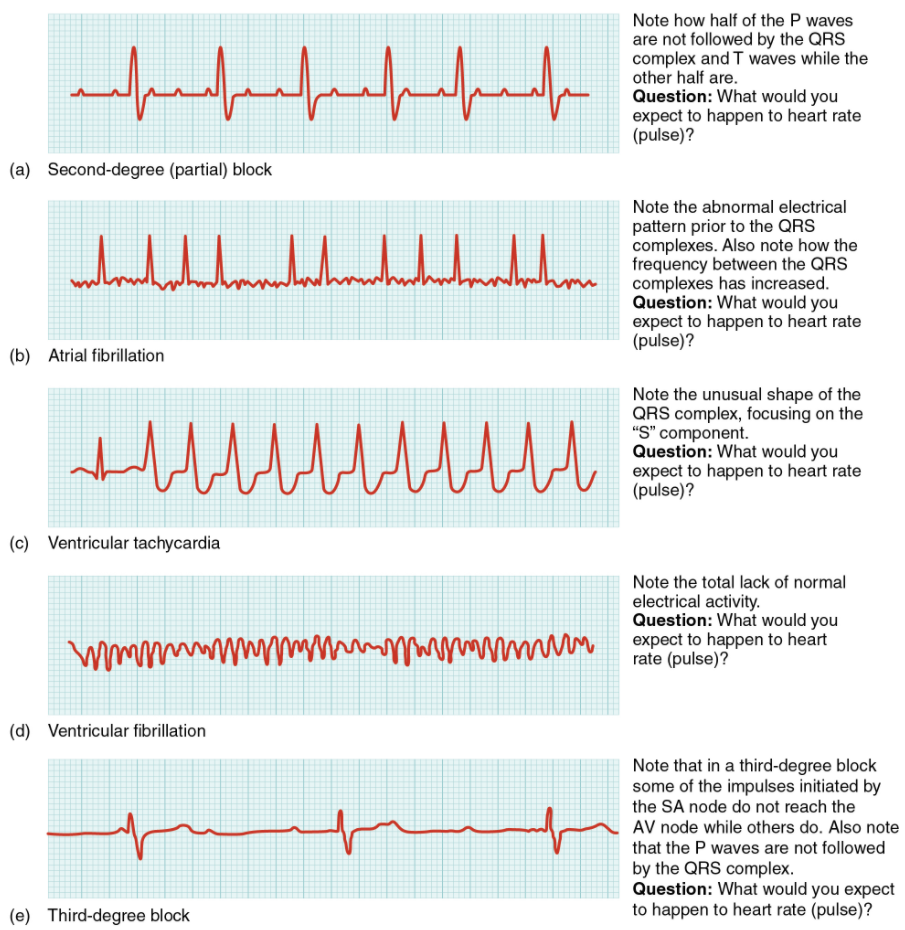 6-2-cardiac-muscle-and-electrical-activity-fundamentals-of-anatomy