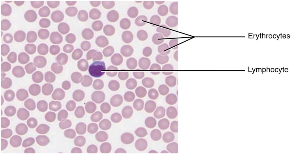 Image of blood