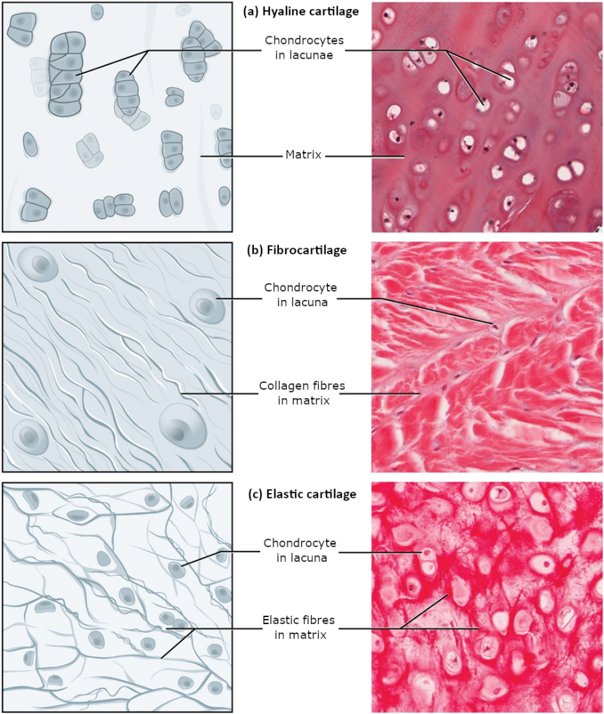 Image of different types of cartilage including hyaline cartilage, fibrocartilage and elastic cartilage