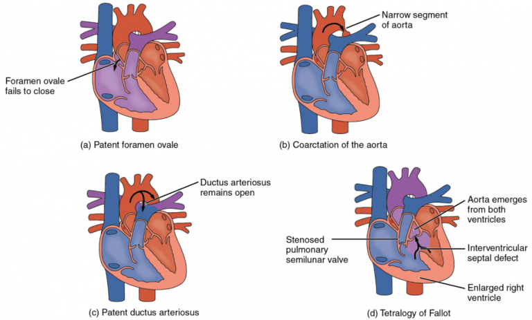 6.1 Heart Anatomy – Fundamentals Of Anatomy And Physiology