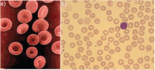 5.3 Erythrocytes – Fundamentals Of Anatomy And Physiology