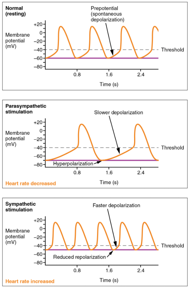 Graph on Effects of parasympathetic and sympathetic stimulation on normal sinus rhythm. 