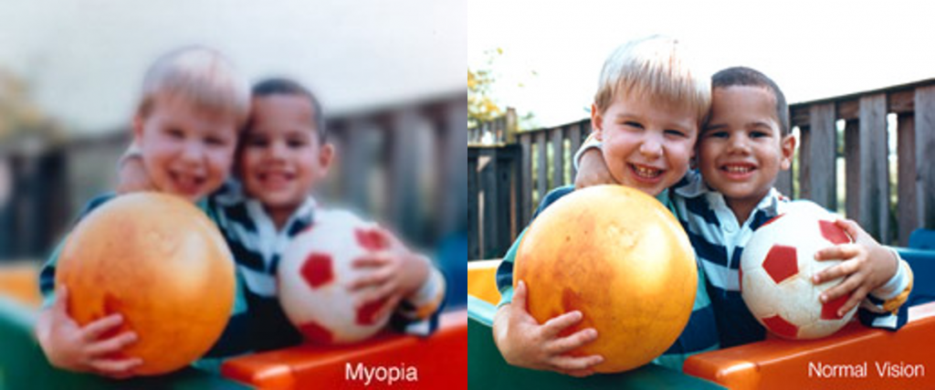 Two image side by side. The left is blurred and the right is clear, highlighting the difference between myopia and normal vision