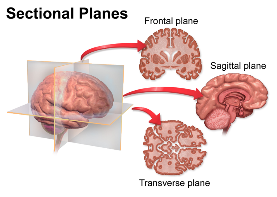 Diagram showing frontal plane, sagittal plane and tranverse plane