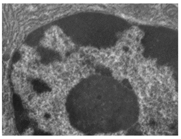 Eukaryotic cells