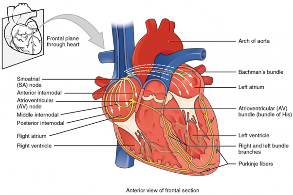 Conduction system of heart with labels to frontal plane through heart, sinoatrial node, anterior intermodal, atrioventricular node, middle internodal, posterior nodal, right atrium, right ventricle, arch of aorta, Bachman's bundle, left atrium, atrioventricular bundle, left ventricle, right and left bundles branches and Purkinje fibers