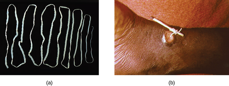 (a) The beef tapeworm b) An adult guinea worm