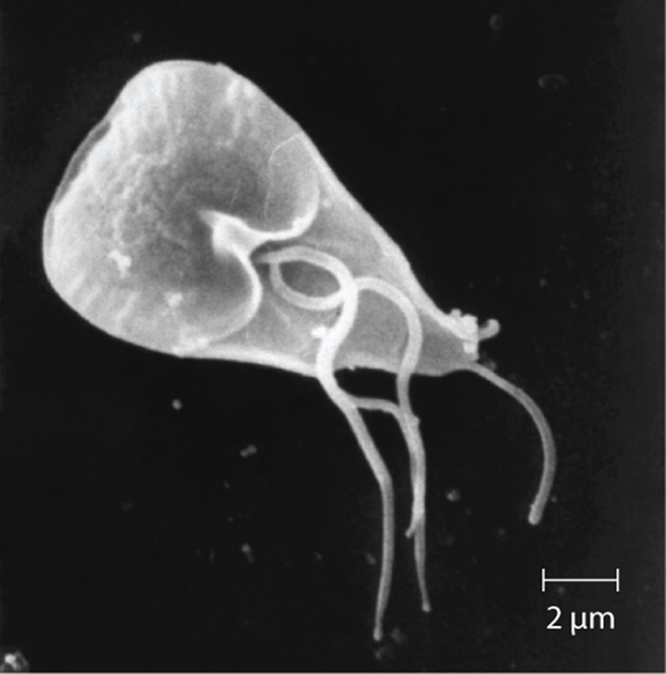 Giardia lamblia, an intestinal protozoan parasite that infects humans and other mammals, causing severe diarrhea